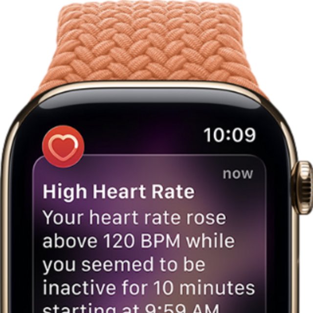 Apple Watch Series 11